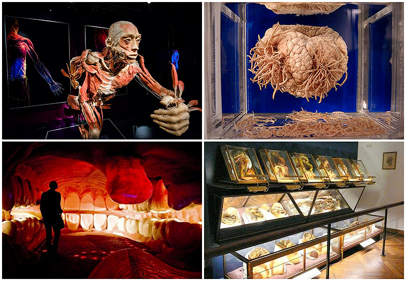 BIGPIC31 6 самых шокирующих анатомических музеев мира